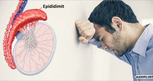 Epididimit