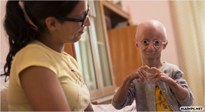 progeria