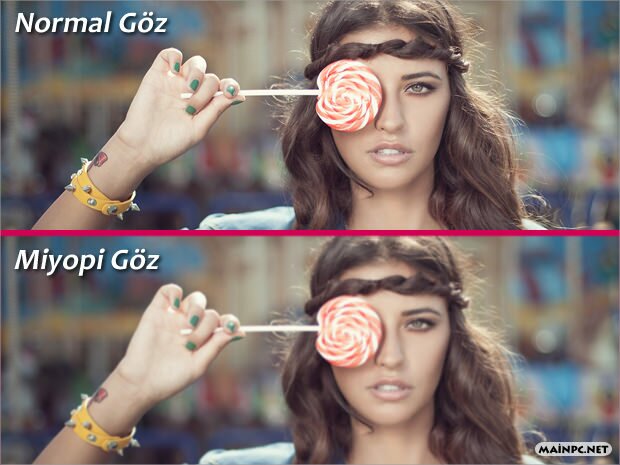 miyopi görünüm