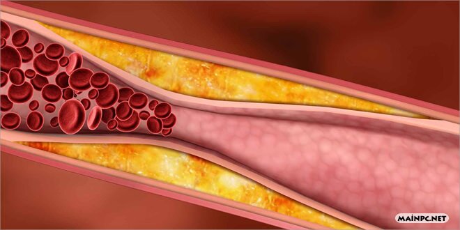 Yüksek Tansiyon (Hipertansiyon)